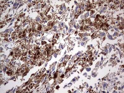 Immunohistochemistry: CD63 Antibody (OTI5E5) [NBP2-46167]