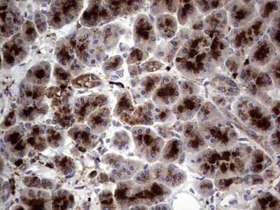 Immunohistochemistry: CD63 Antibody (OTI5E5) [NBP2-46167]