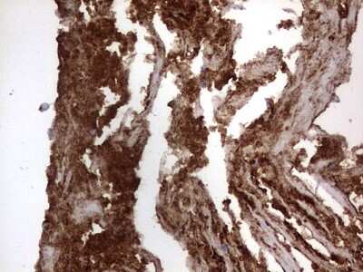 Immunohistochemistry: CD63 Antibody (OTI5E5) [NBP2-46167]