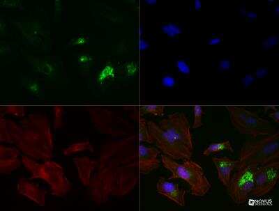 Immunocytochemistry/ Immunofluorescence: CD63 Antibody (H5C6) - BSA Free [NBP2-42225]