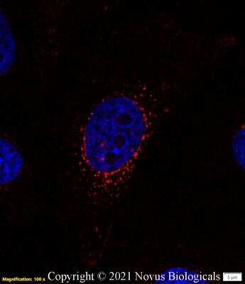 Immunocytochemistry/ Immunofluorescence: CD63 Antibody (H5C6) - BSA Free [NBP2-42225]