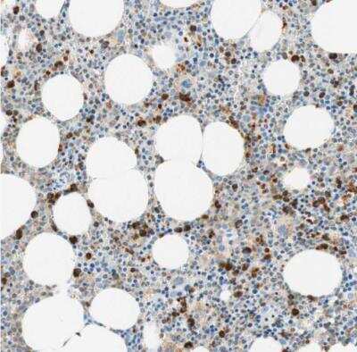 Immunohistochemistry-Paraffin: CD63 Antibody [NBP1-82784]