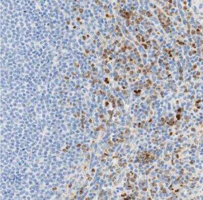 Immunohistochemistry-Paraffin: CD63 Antibody [NBP1-82784]