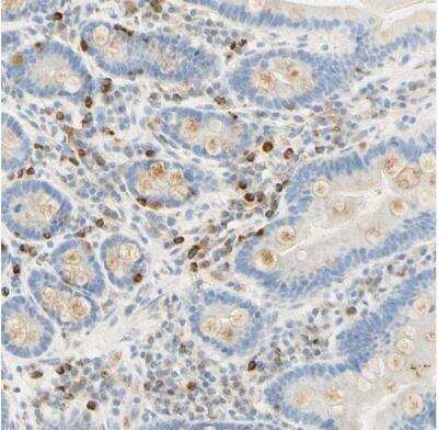 Immunohistochemistry-Paraffin: CD63 Antibody [NBP1-82784]