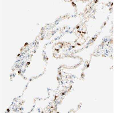 Immunohistochemistry-Paraffin: CD63 Antibody [NBP1-82784]