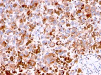 Immunohistochemistry-Paraffin: CD63 Antibody (LAMP3/2788) - Azide and BSA Free [NBP2-78813]