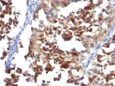 Immunohistochemistry-Paraffin: CD63 Antibody (LAMP3/968) - Azide and BSA Free [NBP2-47936]