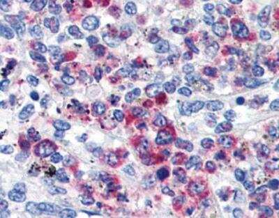 Immunohistochemistry-Paraffin: CD63 Antibody (MEM-259) - BSA Free [NB100-77913]