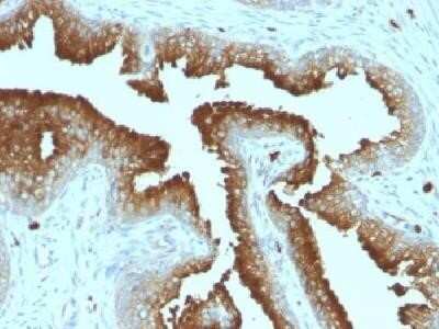 Immunohistochemistry-Paraffin: CD63 Antibody (MX-49.129.5) - IHC-Prediluted [NBP2-44808]