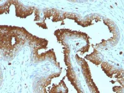 Immunohistochemistry-Paraffin: CD63 Antibody (MX-49.129.5) [NBP2-32830]