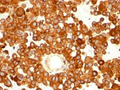 Immunohistochemistry-Paraffin: CD63 Antibody (MX-49.129.5) [NBP2-32830]