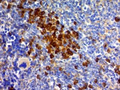 Immunohistochemistry-Paraffin: CD63 Antibody (MX-49.129.5) [NBP2-32830]