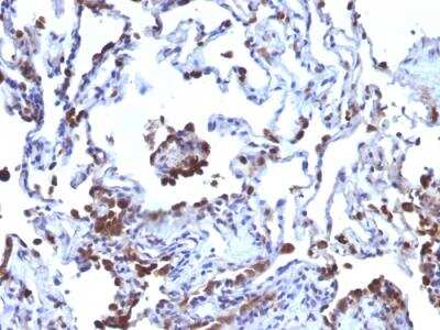 Immunohistochemistry-Paraffin: CD63 Antibody (NKI/C3 + LAMP3/968) - Azide and BSA Free [NBP2-47937]
