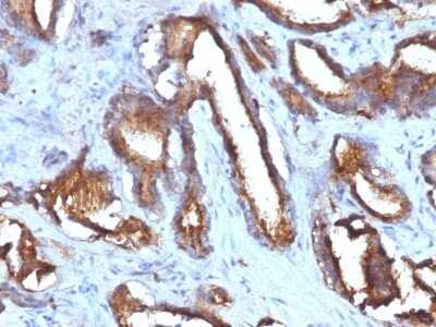 Immunohistochemistry-Paraffin: CD63 Antibody (NKI/C3 + LAMP3/968) [NBP2-44811]