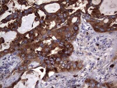 Immunohistochemistry: CD63 Antibody (OTI5E5) - Azide and BSA Free [NBP2-70380]