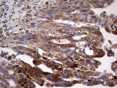Immunohistochemistry: CD63 Antibody (OTI5E5) - Azide and BSA Free [NBP2-70380]