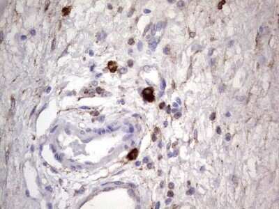 Immunohistochemistry: CD63 Antibody (OTI5E5) - Azide and BSA Free [NBP2-70380]