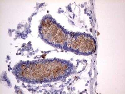 Immunohistochemistry: CD63 Antibody (OTI5E5) - Azide and BSA Free [NBP2-70380]