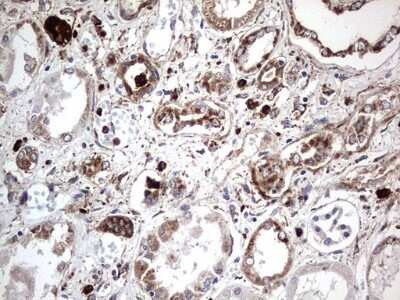 Immunohistochemistry: CD63 Antibody (OTI5E5) - Azide and BSA Free [NBP2-70380]