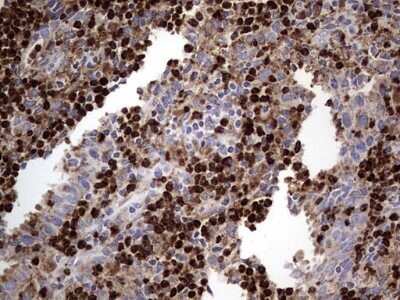 Immunohistochemistry: CD63 Antibody (OTI5E5) - Azide and BSA Free [NBP2-70380]