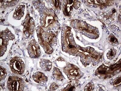 Immunohistochemistry: CD63 Antibody (OTI5E5) - Azide and BSA Free [NBP2-70380]