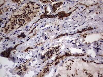 Immunohistochemistry: CD63 Antibody (OTI5E5) - Azide and BSA Free [NBP2-70380]