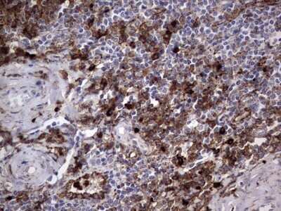 Immunohistochemistry: CD63 Antibody (OTI5E5) - Azide and BSA Free [NBP2-70380]