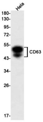 Western Blot: CD63 Antibody (S08-7C9) [NBP3-20035]
