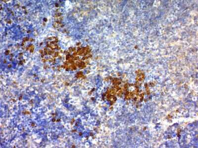 Immunohistochemistry-Paraffin: CD63 Antibody (SPM524) - Azide and BSA Free [NBP2-34779]