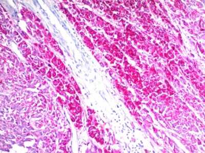 Immunohistochemistry-Paraffin: CD63 Antibody (SPM524) - IHC-Prediluted [NBP2-44807]
