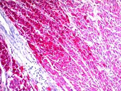 Immunohistochemistry-Paraffin: CD63 Antibody (SPM524) [NBP2-32943]