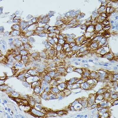 Immunohistochemistry-Paraffin: CD64/FCGR1B Antibody - Azide and BSA Free [NBP2-92763]