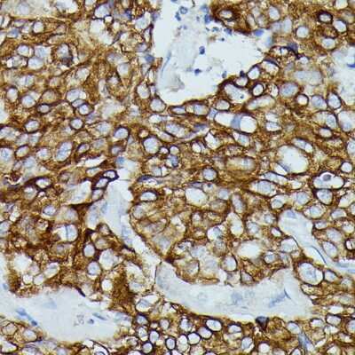 Immunohistochemistry-Paraffin: CD64/FCGR1B Antibody - Azide and BSA Free [NBP2-92763]