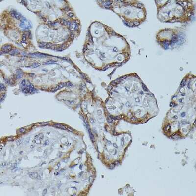 Immunohistochemistry-Paraffin: CD64/FCGR1B Antibody - Azide and BSA Free [NBP2-92763]