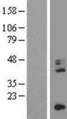 Western Blot: CD68/SR-D1 Overexpression Lysate [NBL1-08962]