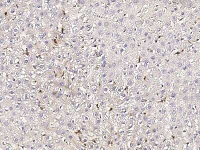 Immunohistochemistry-Paraffin: CD68/SR-D1 Antibody (001) [NBP2-90914]