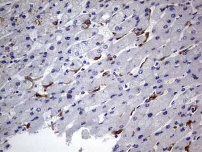 Immunohistochemistry: CD68/SR-D1 Antibody (OTI1E6) [NBP2-46168]