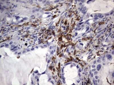 Immunohistochemistry: CD68/SR-D1 Antibody (OTI1E6) [NBP2-46168]