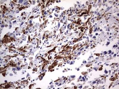 Immunohistochemistry: CD68/SR-D1 Antibody (OTI1E6) [NBP2-46168]