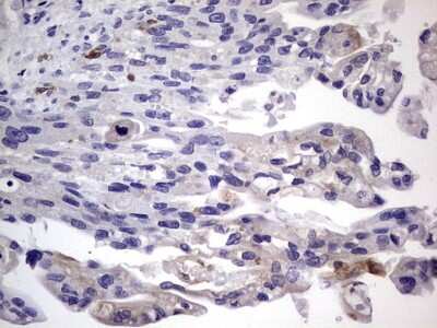 Immunohistochemistry: CD68/SR-D1 Antibody (OTI1E6) [NBP2-46168]