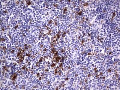 Immunohistochemistry: CD68/SR-D1 Antibody (OTI1E6) [NBP2-46168]