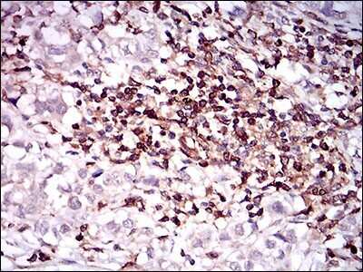 Immunohistochemistry-Paraffin: CD68/SR-D1 Antibody (3F7D3) - BSA Free [NBP2-37265]