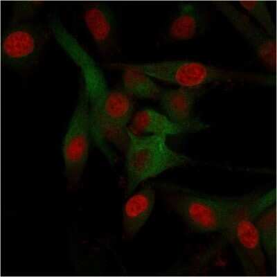 Immunocytochemistry/ Immunofluorescence: CD68/SR-D1 Antibody (C68/684) - Azide and BSA Free [NBP2-34587]