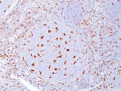 Immunohistochemistry-Paraffin: CD68/SR-D1 Antibody (C68/684) - Azide and BSA Free [NBP2-34587]