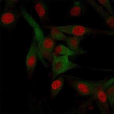 Immunocytochemistry/ Immunofluorescence: CD68/SR-D1 Antibody (C68/684) [NBP2-32832]