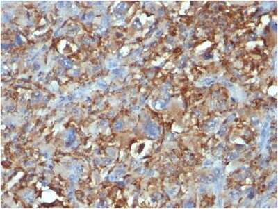 Immunohistochemistry-Paraffin: CD68/SR-D1 Antibody (C68/684) [NBP2-32832]