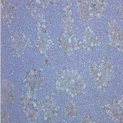 Immunohistochemistry-Paraffin: CD68/SR-D1 Antibody (ED1) - BSA Free [NB600-985]