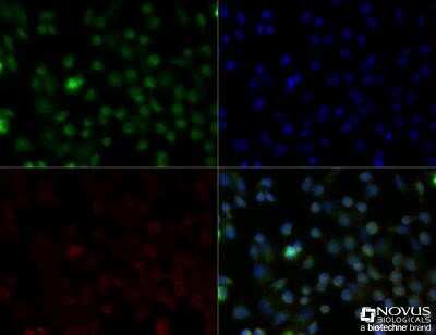 Immunocytochemistry/ Immunofluorescence: CD68/SR-D1 Antibody (FA-11) - Azide and BSA Free [NBP2-80656]