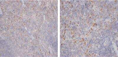 Immunohistochemistry-Paraffin: CD68/SR-D1 Antibody (FA-11) - BSA Free [NBP2-33337]