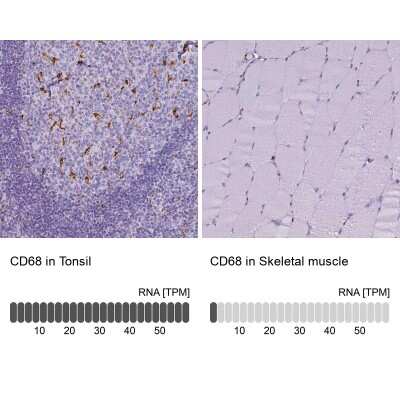 Immunohistochemistry-Paraffin: CD68/SR-D1 Antibody [NBP2-48923]